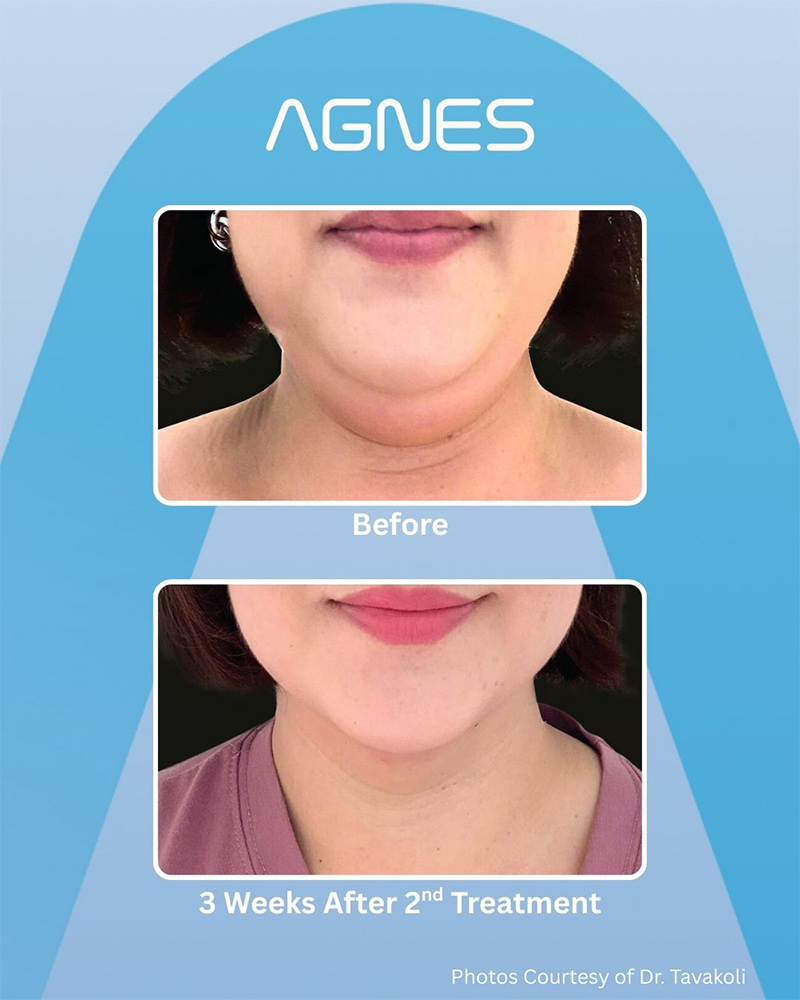 Picture of About Agnes