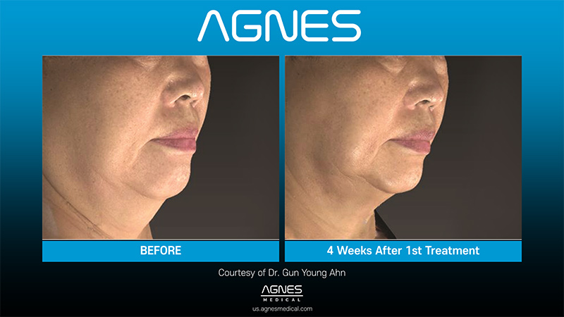 Picture of About Agnes