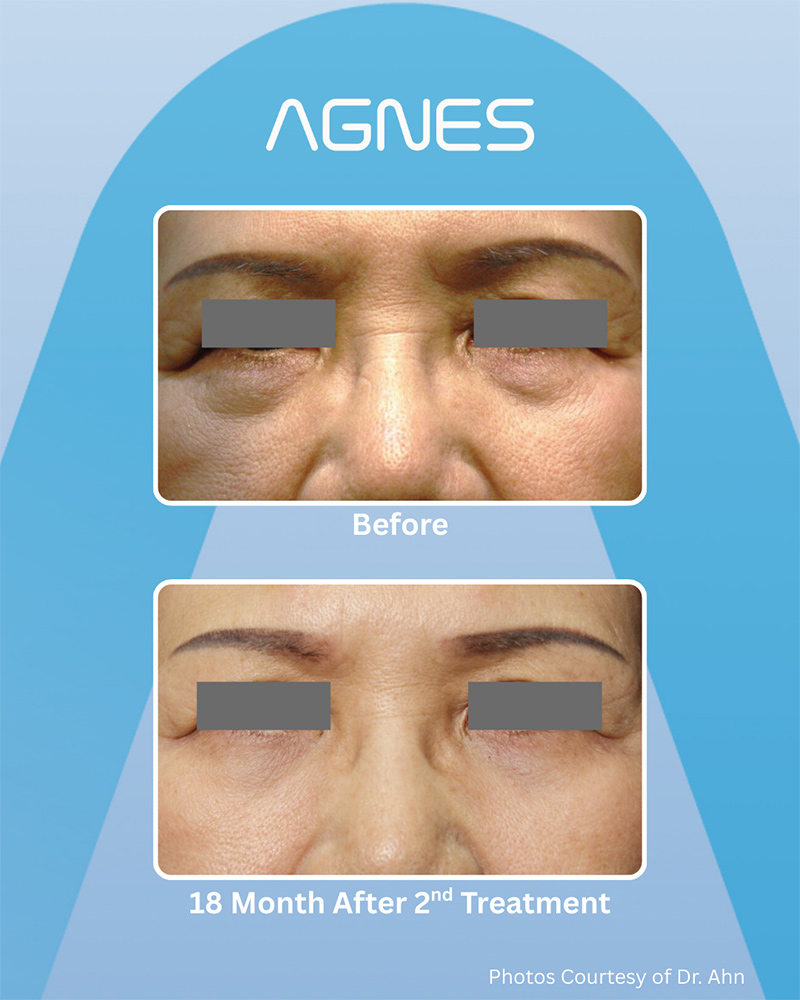 Picture of About Agnes