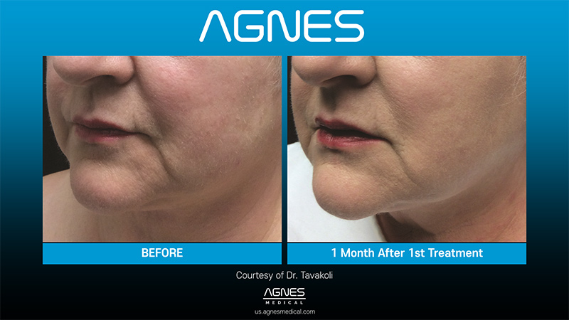 Picture of About Agnes