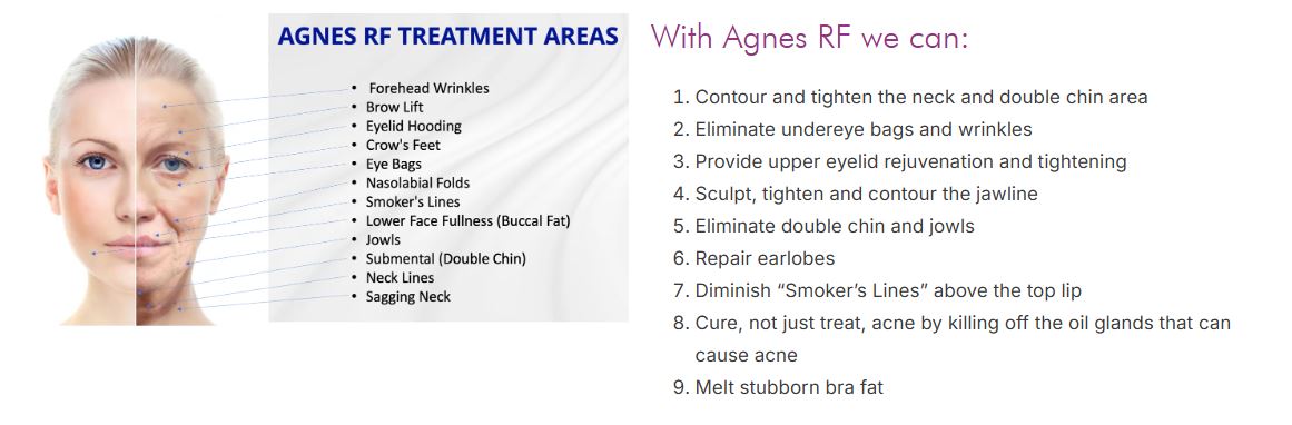 Picture of About Agnes RF