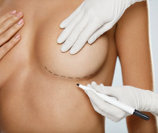 breast implant exchange bay area