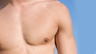 Picture of ArtfulSurgery Gynecomastia Lafayette California Bay area