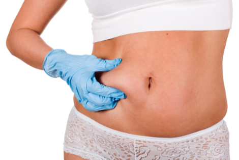 Picture of Liposuction