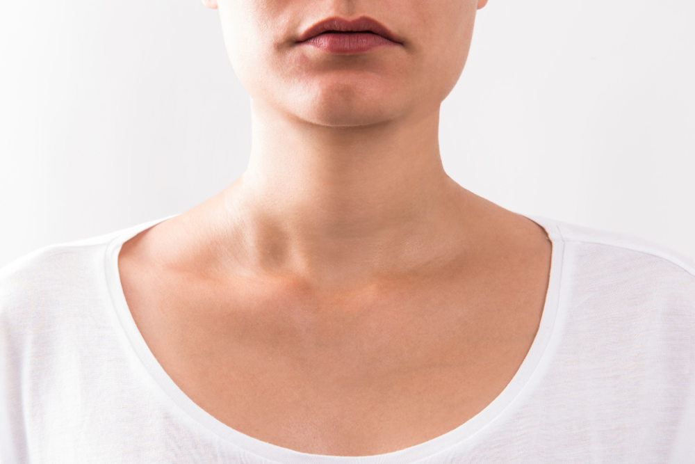 Picture of neck lift lafayette