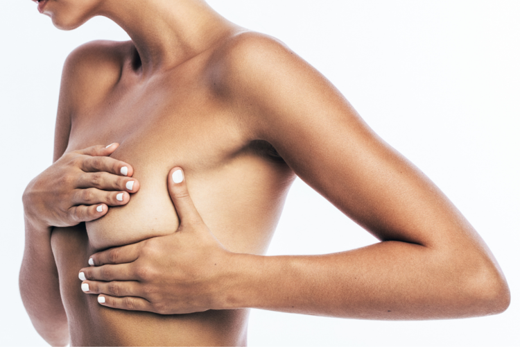 Client ready for a breast reduction near South Bay, CA